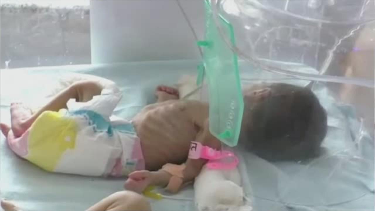 Newborn girl found buried alive in pot in India