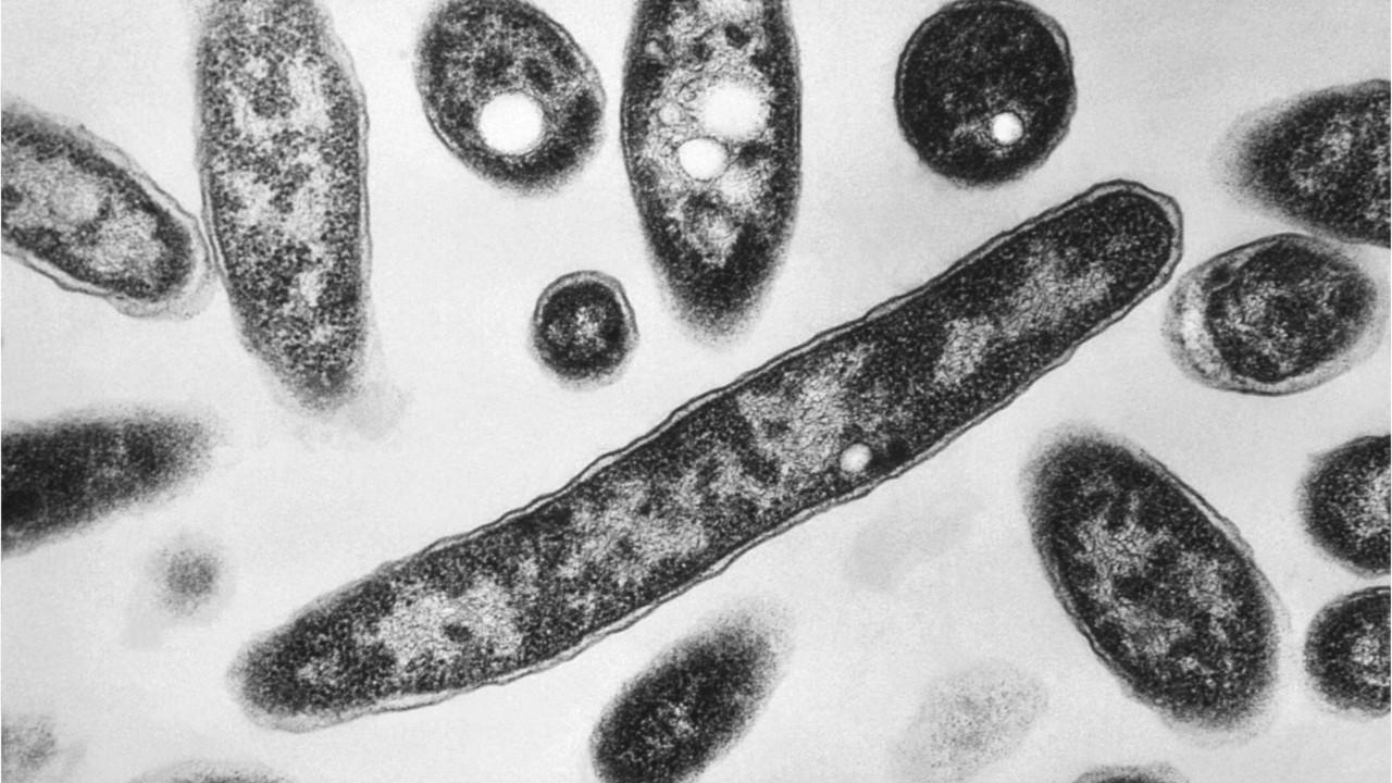 Officials: Legionnaires' disease outbreak linked to North Carolina state fair kills 3rd person