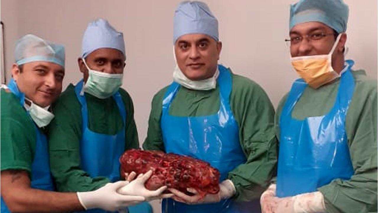 Surgeons remove 16-pound cyst-covered kidney from patient