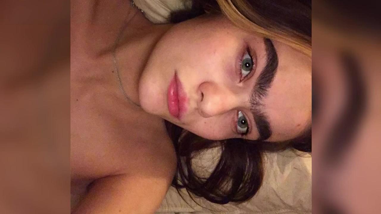 Unibrow Teen says she's inundated with dating requests