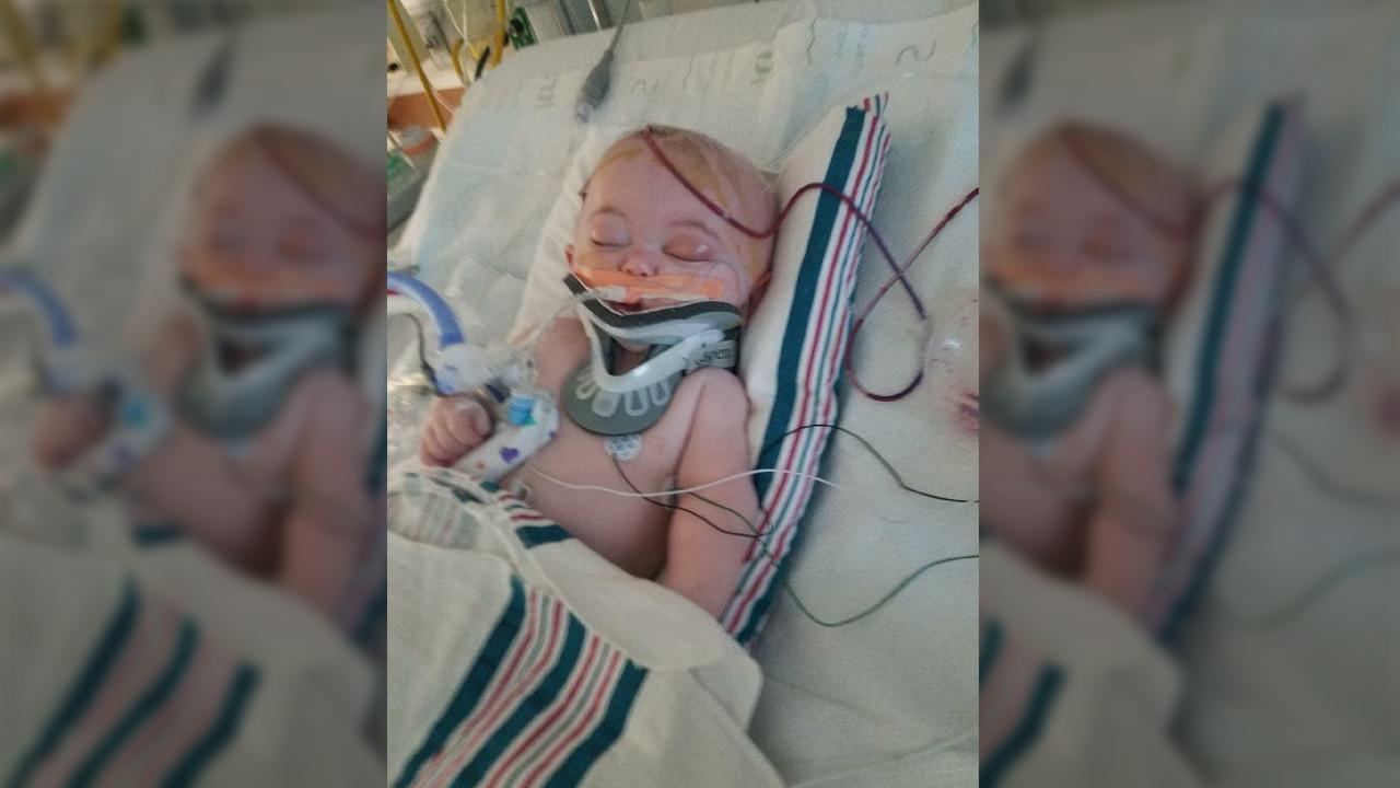 Infant suffers brain damage after falling off bed
