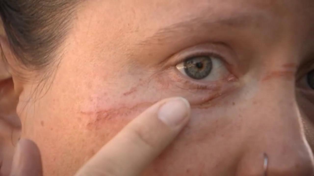 Image result for Booby trap on bike path in Portland injuries bicyclist; 3 men arrested, police say