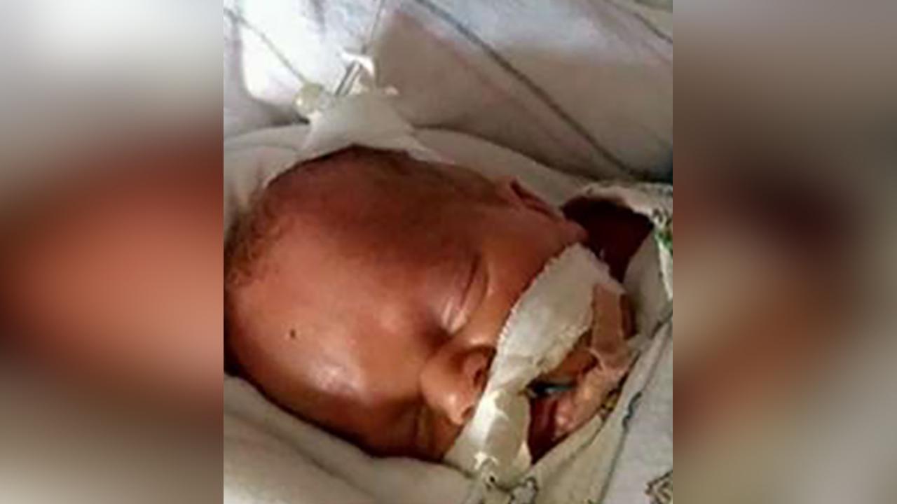 Miracle Baby Survives After Being Given Less Than Percent Chance Of