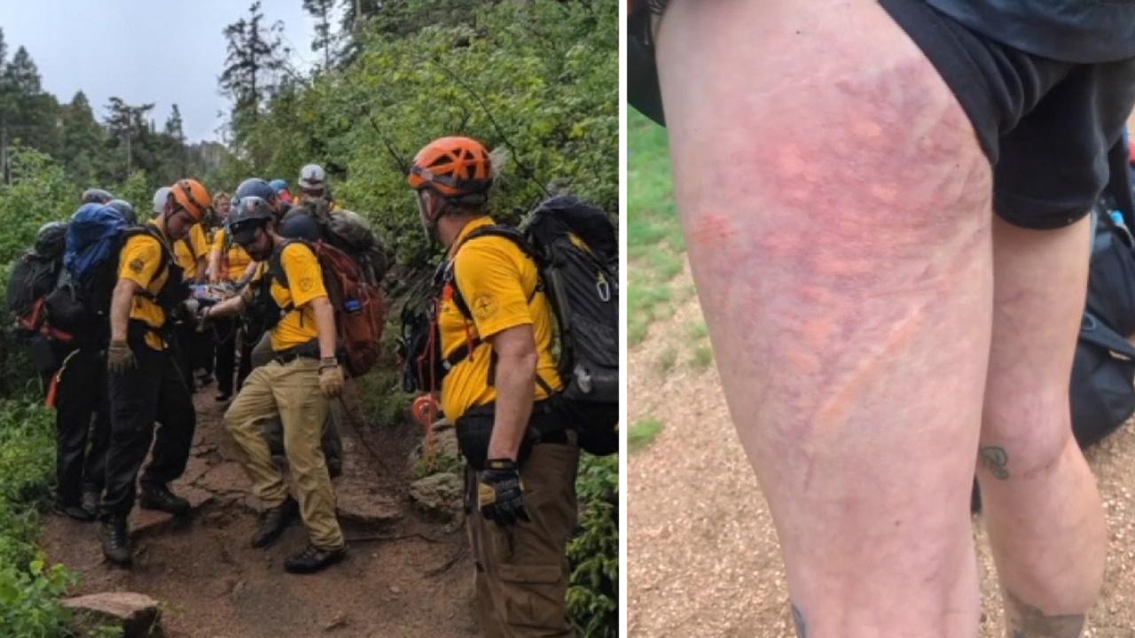 Lightning strike in Colorado injures 8 hikers, 1 critically, officials say  | Fox News