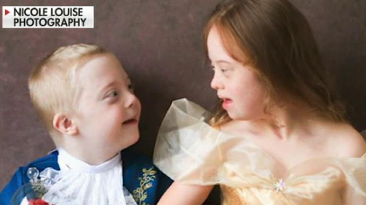 Baby Girl With Down Syndrome Goes Viral After Showing My Xxx Hot Girl